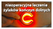 Nieoperacyjne leczenie